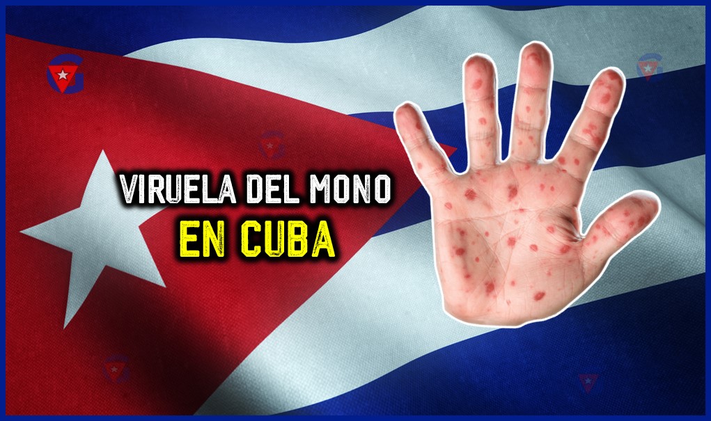 Viruela del Mono en Cuba 2024: Situación y Medidas gentecuba.com